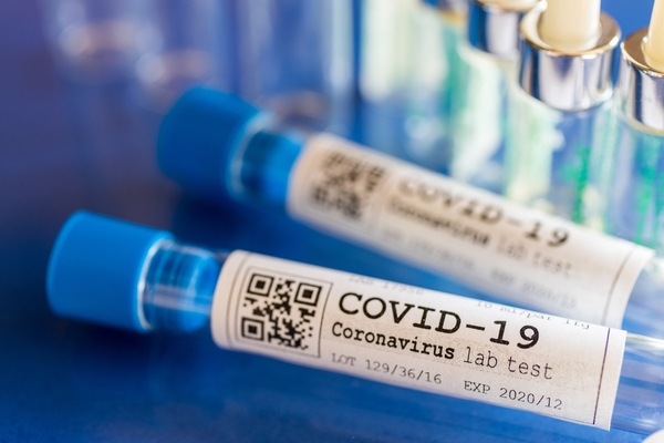 BayCare introduces drive-through testing for coronavirus